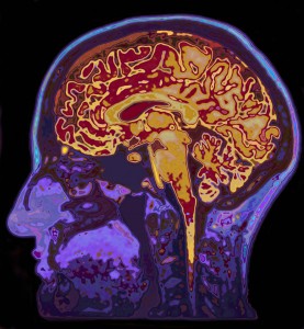 brain-scan